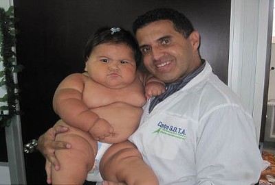 Sosok Juanita, Bayi asal Kolombia dengan Bobot 20 Kg