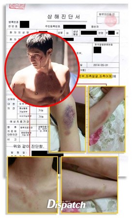 Kim Hyun Joong Didenda Rp 58,5 Juta Atas Kasus Penyiksaan