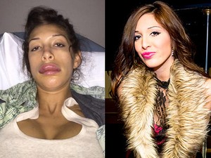 Pasca Bibir Jontor karena Suntik, Farrah Abraham Kini Sudah Cantik Lagi