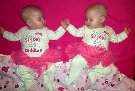 Nyaris Kehabisan Oksigen Karena Kondisi Langka, Bayi Kembar ini Selamat