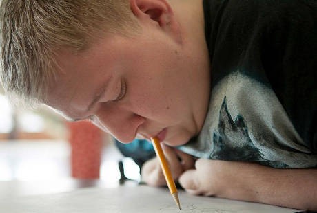 Kena Sakit Langka, Smith Hanya Bisa Melukis dengan Mulut nya