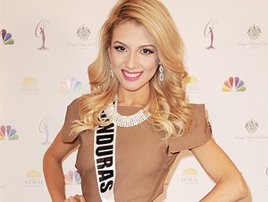 Jelang Miss Universe, Miss Honduras Cuma Makan Putih Telur dan Kalkun