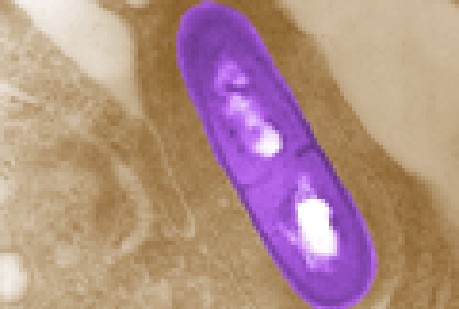 Bakteri Listeria yang Cemari Apel Impor Bisa Ada di Kulit atau Daging Buah