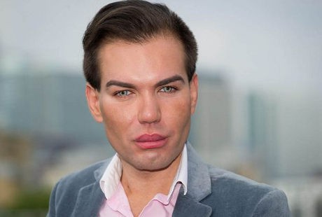 Terobsesi pada Pacar Barbie, Pria Ini Rela 30 Kali Operasi Permak Tubuh