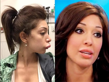Bibir Jontor karena Suntik, Farrah Abraham Tak Kapok Implan Bokong
