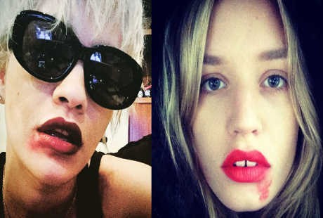 Selfie dengan Lipstik Belepotan, Kampanye Kesadaran Kanker Mulut Rahim