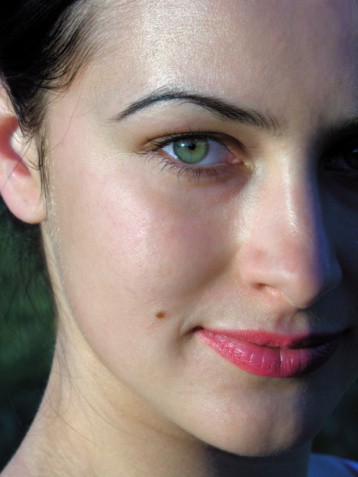 Kenali, Ini Tanda-tandanya Tahi Lalat Jadi Pertanda Kanker