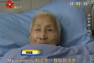 Bangun Koma Pasca Stroke, Wanita Tiongkok ini Jadi Mahir Bahasa Inggris
