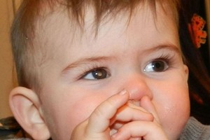 Berkat Lampu Flash Kamera, Bocah Ini Selamat dari Retinoblastoma