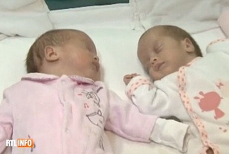 Kontraksi Tiba-tiba Berhenti, Kembar Ini Lahir di Tahun yang Berbeda