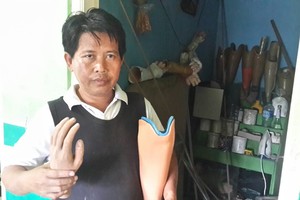 Usaha Kaki Palsu Kurang Modal, Ali Menjerit karena Nyaris Bangkrut