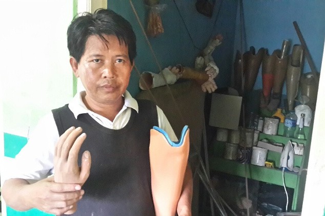 Usaha Kaki Palsu Kurang Modal, Ali Menjerit karena Nyaris Bangkrut