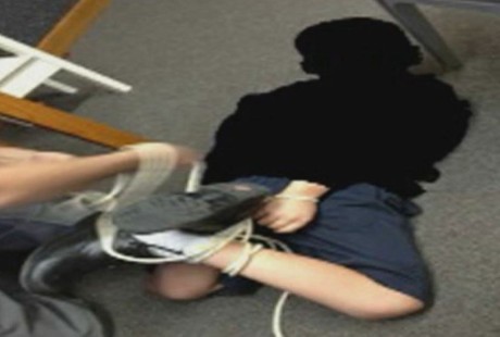 Anak Ini Begitu Bandelnya Sampai Harus Diikat Dokter