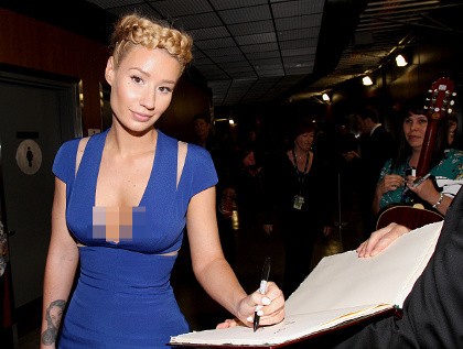 Diejek karena Punya Selulit, Iggy Azalea Tinggalkan Twitter