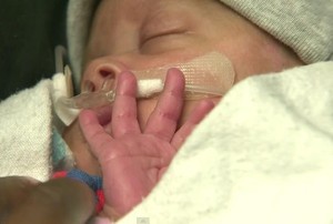 Bayi Prematur Ini Lahir dengan Kantong Ketuban Masih Utuh