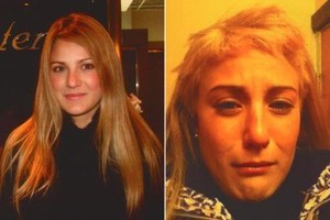 Rambut Nyaris Botak, Model Cantik Tuntut Salon Terkenal di NY Rp 19 M