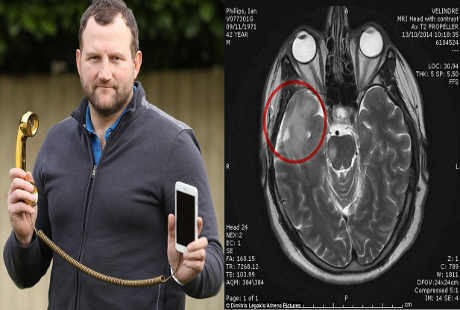6 Jam Pakai Ponsel Tiap Hari, Pria Ini Kena Tumor Otak