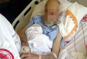 Patah Hati Ditinggal Selingkuh, Pria Ini Potong Kemaluannya Sendiri