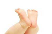 flat foot pada bayi