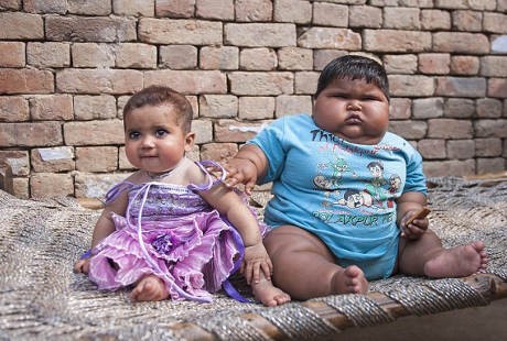 Ya Ampun! Bobot Bayi Ini Mencapai 12 Kg di Usia 10 Bulan