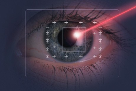 Hendak Operasi Lasik? Ini Dia Daftar Biayanya