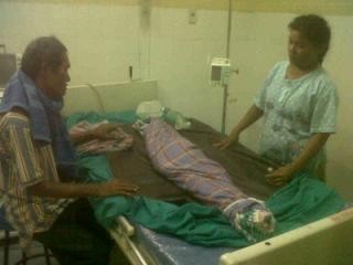 Bocah yang Dibakar Temannya Akhirnya Meninggal Dunia