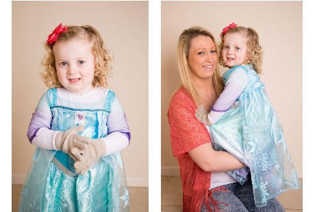 Idap Sindrom Raynaud, Bocah 2 Tahun Ini Jadi Putri Elsa di Dunia Nyata