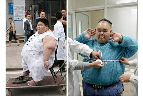 Diberi Gelar Pria Tergemuk di Tiongkok, Yong Susutkan Bobot 83 Kg