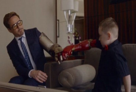 Lengan Tak Sempurna Sejak Lahir, Alex Dihadiahi Tangan Iron Man