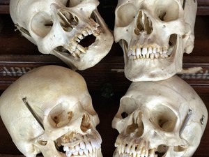 Toko Suvenir Aneh di Amerika, Jual Tengkorak Manusia