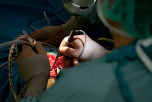 Ilmu Baru, Masih Sedikit Dokter di RI yang Bisa Operasi Otak Pasien Parkinson