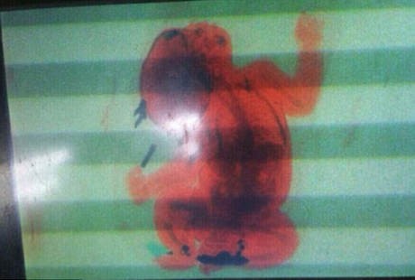 Tak Bawa Surat Lengkap, Ibu Muda Selundupkan Bayi dalam Tas