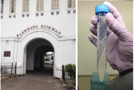 Mengintip Prosedur Identifikasi DNA di Laboratorium