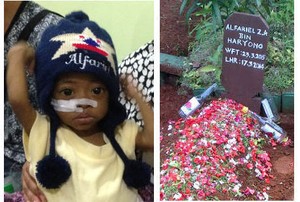 Selamat Jalan Alfariel, Balita yang Berjuang Lawan Caroli Disease