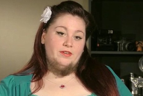 Punya Jenggot, Wanita Ini Sempat Minder dan Ketakutan Saat Keluar Rumah