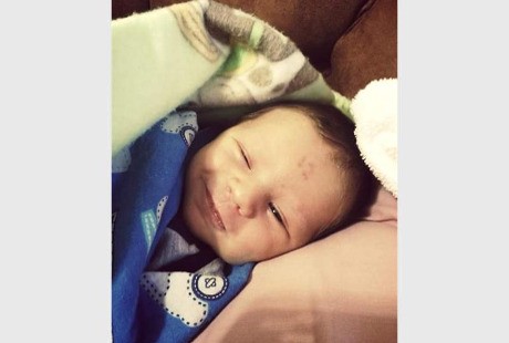 Unik, Bayi Ini Punya Tanda Lahir Berbentuk Angka 12 di Kening