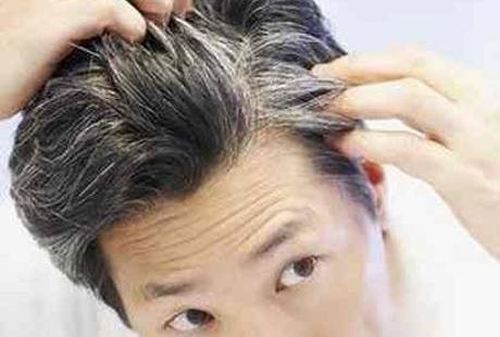 Masih Muda Tapi Rambut Sudah Beruban? Bisa Jadi Ini Sebabnya