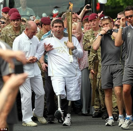 Kisah Ben, Bisa Berjalan Kembali Setelah Kehilangan Sepasang Kaki