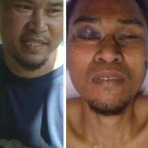 Istri pun Membenarkan Teroris yang Tertembak Adalah Daeng Koro