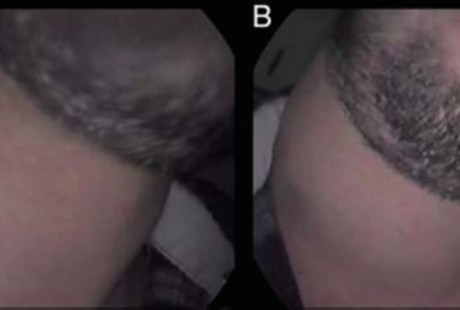 Sering Meniup Trompet, Leher Pria Ini Bisa Menggelembung Seperti Kodok