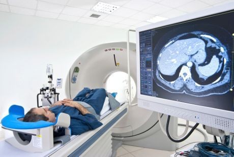 FAST, Cara Mudah Deteksi Stroke dalam Waktu Singkat