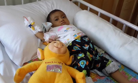 Kuning Saat Lahir Dikira Kurang Dijemur, Meghan Ternyata Kena Atresia Bilier