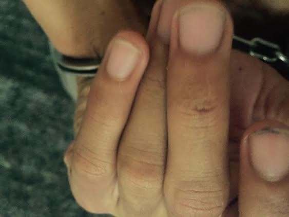 Deudeuh Tataa Chubby Sempat Melawan Saat RS Mencekik Lehernya