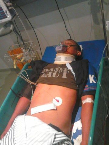 Kondisi Membaik, Satpam yang Dipukul Penumpang KA Diperbolehkan Pulang