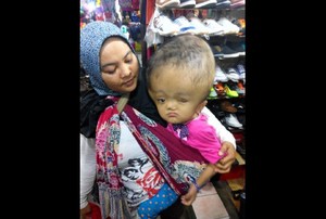 Anak Kena Hidrosefalus, Ibu Ini Keliling Senen dan Jatinegara Cari Donasi