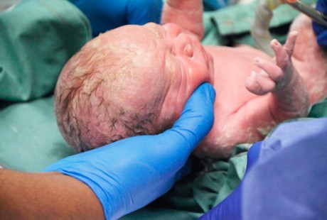 Pertumbuhan Bayi Terhambat karena Lahir Prematur, Begini Cara Mencegahnya