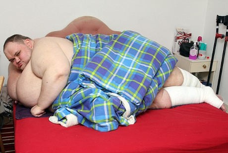 Pria Tergemuk di Inggris, Makan 10.000 Kalori Sehari Hingga Bobotnya 412 Kg