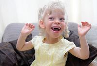 Синдром Эльфа У Ребенка Фото С Пояснениями