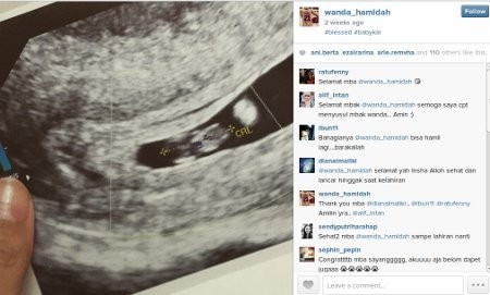 Dua Bulan Menikah dengan Daniel, Wanda Hamidah Hamil