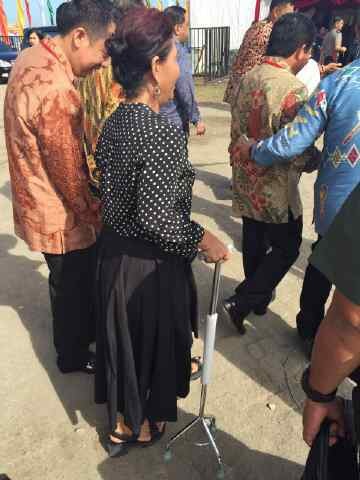 Jatuh dari Speedboat, Menteri Susi Berjalan Pakai Tongkat